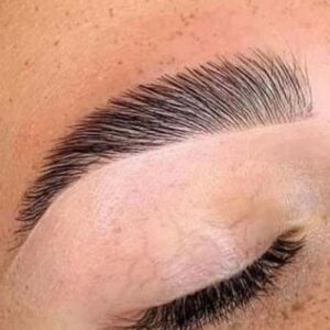 Formation Brow Lift